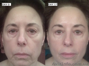 Nu Skin (Ну Скин) в Украине. Система ageLOC Преображение. Акция!!! #9684