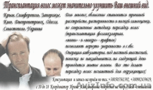 Пересадка волос. Трансплантация собственных волос #8486