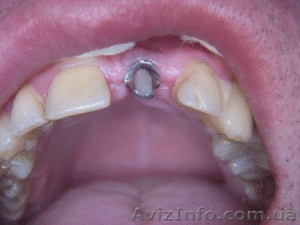 Стоматология в Полтаве #5104