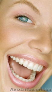 Имплантация,  лечение зубов,  протезирование зубов в полтаве #175392