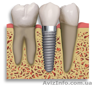 Импластика  частная стоматологическая клиника #308528