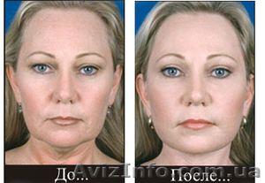 Лазерное омоложение. Лазер СО2 ДОТ(SmartXide DOT)   #384067