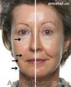 омоложение кожи лица и тела #395833