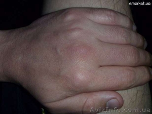 МАССАЖ,  общий,  антицелюлитный,  лечебный #441528