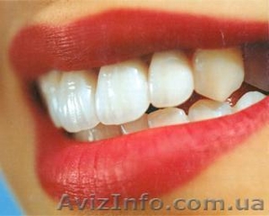 Зубные мосты (протезирование зубов) в Харькове #428267