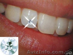Стразы на зубы,  отбеливание зубов (Харьков) #428295