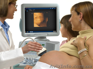 узи аппараты esaote MyLab 70 #566570