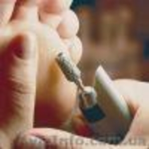 Аппаратный педикюр #599855