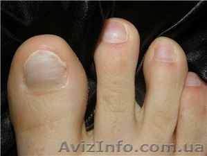 Наращивание ногтей на НОГАХ!!! #632879