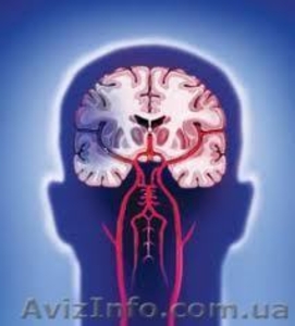 Вызов невропатолога на дом 200 грн #670558