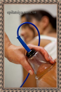 Аппаратный антицеллюлитный массаж #707817