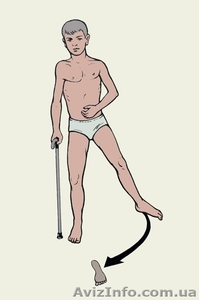 программа реабилитации,  ЛФК,  массаж #804971