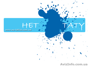 Удаление сосудов,  пигментных пятен,  татуировок и татуажа!  #828521