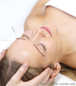 Лечение бессонницы иглоукалыванием #837147