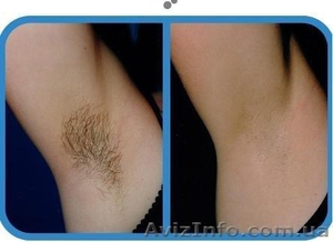 Восковая профессиональная депиляция воском.метро Лукяновка  #887906