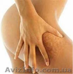 Сеанс антицеллюлитного массажа,  подготовим тело к лету!  #889785