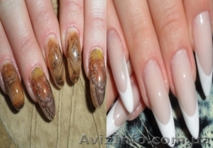 Обучение наращиванию ногтей Ирпень,  Киев #906668