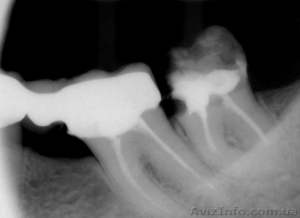   радиовизиограф Vatech HDS 150S #899906