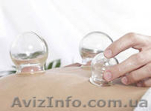 Баночный массаж. Баночный массаж Николаев. Баночный массаж в Николаеве. Массаж. #1078713