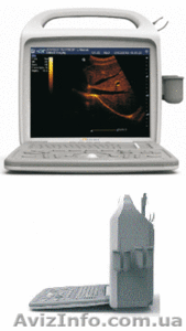 Портативный серошкальный аппарат УЗИ iuStar 160 (B/W) #1076182