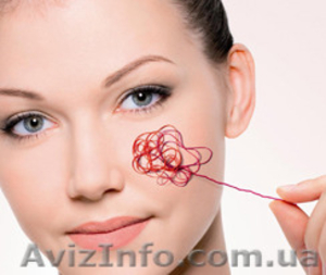 Лазерное удаление сосудистой сетки,  звездочек #1080790