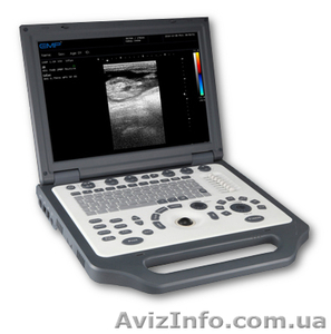 УЗИ аппарат EMP G30 vet #1085938
