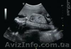 Ультразвукова система Logiq C5 Premium #1120715