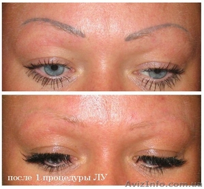 Удалить татуаж (перманентный макияж) лазером – 150 грн - Днепропетровск #1174162