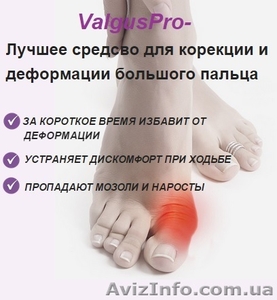 Супер цена!!! Успейте купить Valgus Pro!!!  #1171178