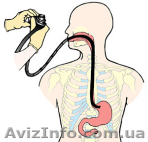 Фиброгастродуоденоскопия (ФГДС) #1233781