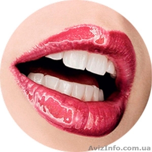 Отбеливание зубов системой Beyond Polus в Киеве в ЭстетСмайл #1358585