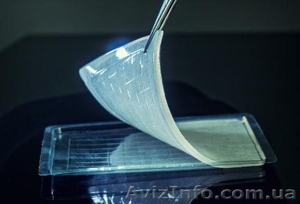 Гелевые салфетки Хилер #1374960