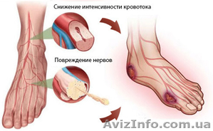 Cupron - диабетические носки #1508762