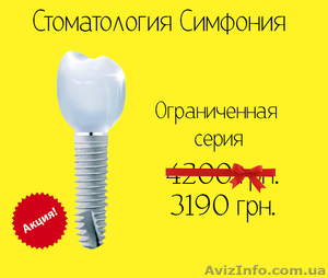 Имплантация зубов 3190 грн. с гарантией #1508117