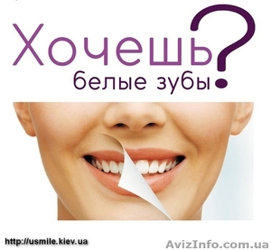 Хочешь белые зубы? #1523181