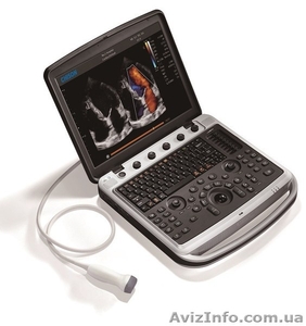 Аппарат УЗИ Chison SonoBook 9 с двумя датчиками #1618406