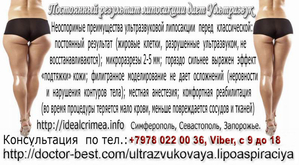 Ультразвуковая липосакция. Красивое тело всем к лицу!   #43576