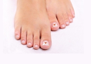 Коррекция вросшего ногтя. Услуги подолога Харьков.  #1665072