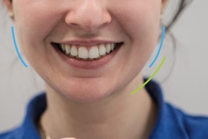 D.Ante - современная стоматология в центре Киева #1714235