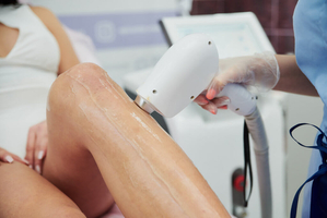 Курс лазерной эпиляции в Днепре #1718516